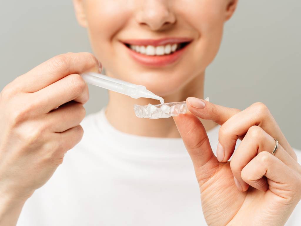 teeth whitening options .jpg